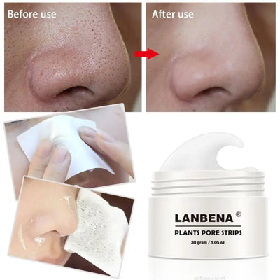 LANBENA Blackhead Remover Cream - Acne Treatment, Pore Strips Nose Peel Off Mask, 30g + 60 Pcs Paper
