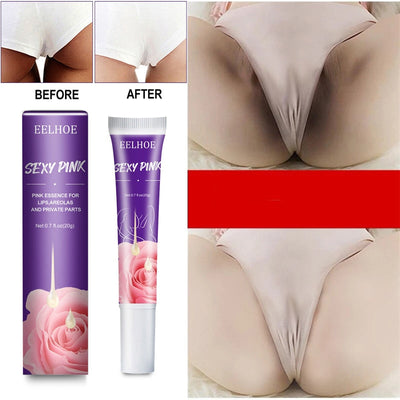 Women Skin Whitening Cream Remove Melanin Emulsion Brighten Inner Thigh Whiten Butt Knee Private Parts Underarm Bleaching Serum