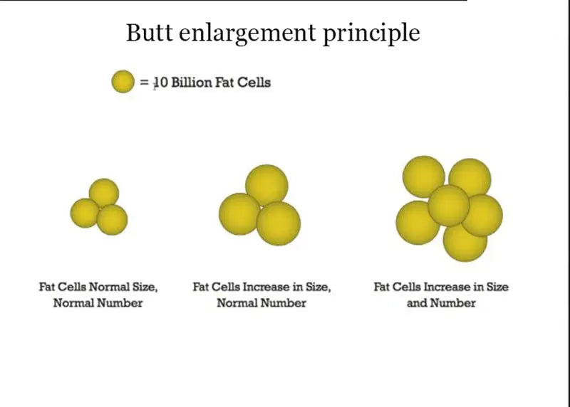 Butt enlargement oil - get bigger butt fast with 30ml west africa hip enhancement oil