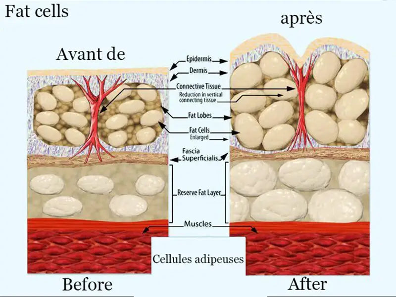 Butt enlargement oil - get bigger butt fast with 30ml west africa hip enhancement oil